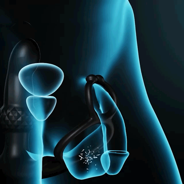 💥2025 Exclusive Deal - 75% OFF🔥SUPTRUCK Kiwinet Plugon X7🔥3 IN 1 Prostate Massager